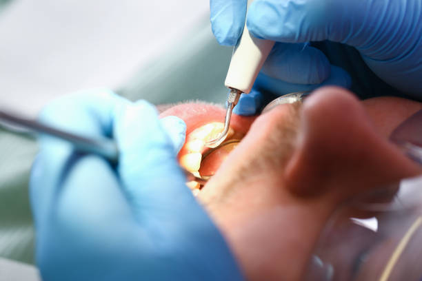 Best Emergency Wisdom Teeth Removal in West Fork, AR